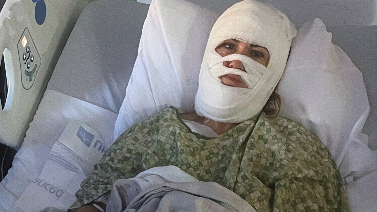 Ashley Wasielewski recovers from injuries with bandages on her face