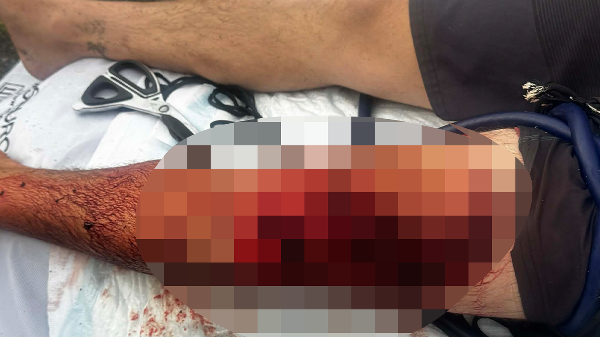 Shark bites fisherman