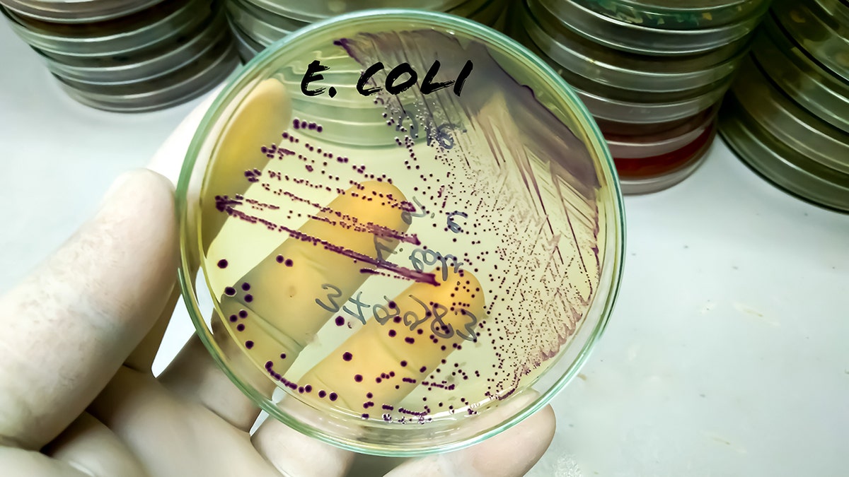 Scientist holds bacteria culture growth on chromogenic media plate in lab labeled Escherichia coli (E. coli).