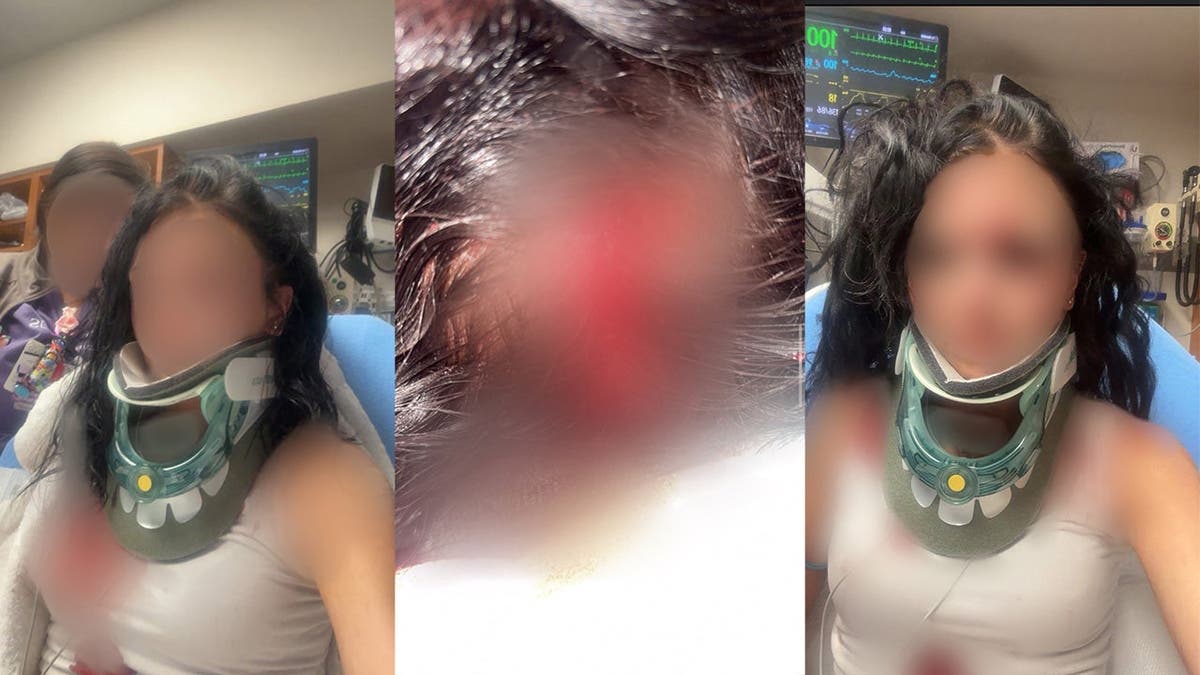 image shows three split photos of a woman's injuries that have been blurred